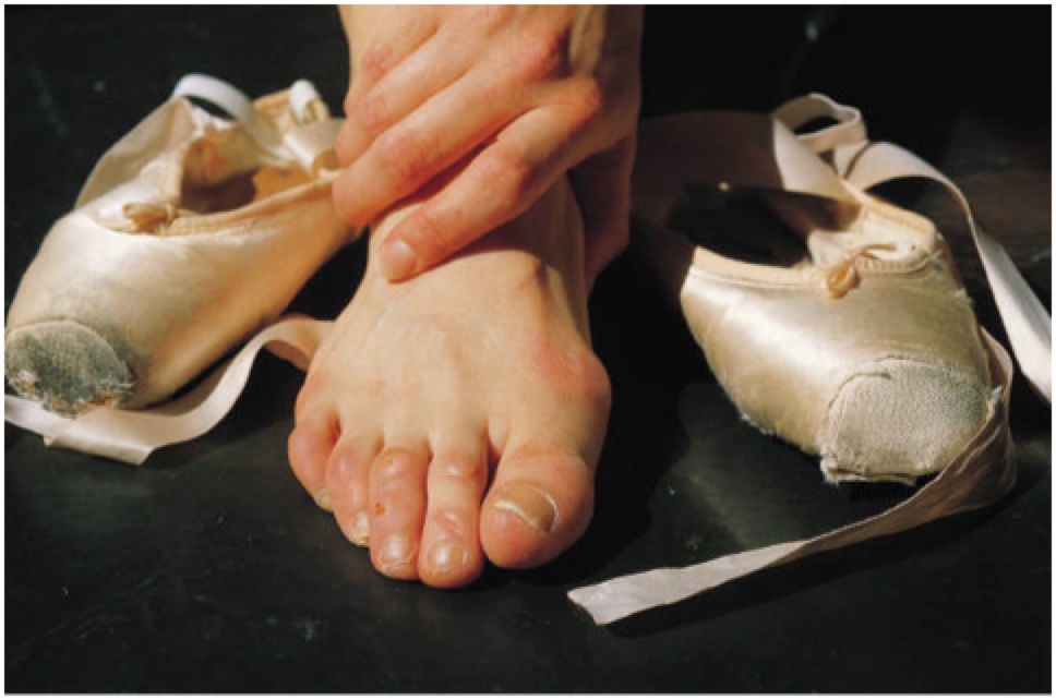 dancer toes