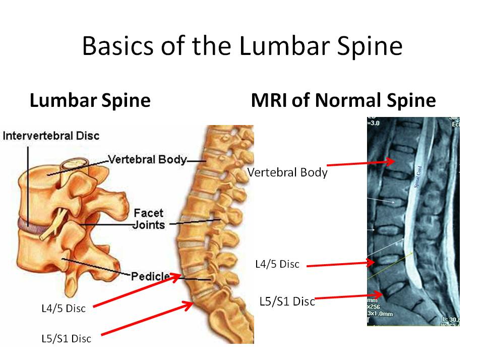 lumbar and sacral